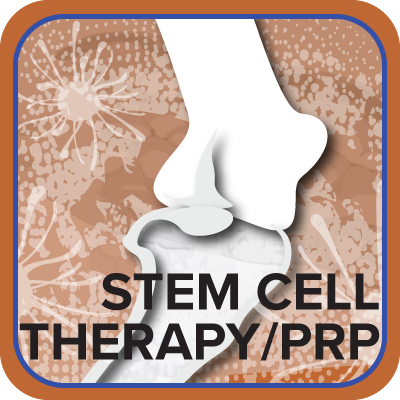Stem Cell Therapy PRP